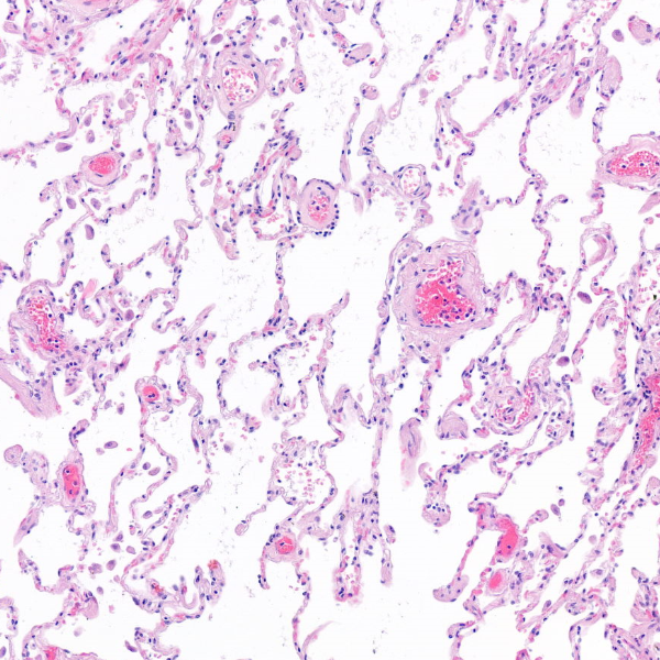 Die Pathologie hilft bei der Diagnose Krebs